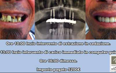 Impianti dentali 24 ore sogno o realtà?