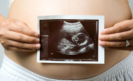 ecografie in gravidanza reggio emilia