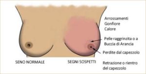 ecografia al seno