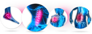 tecarterapia fisioterapia reggio emilia