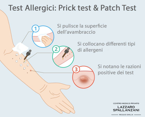 test allergici