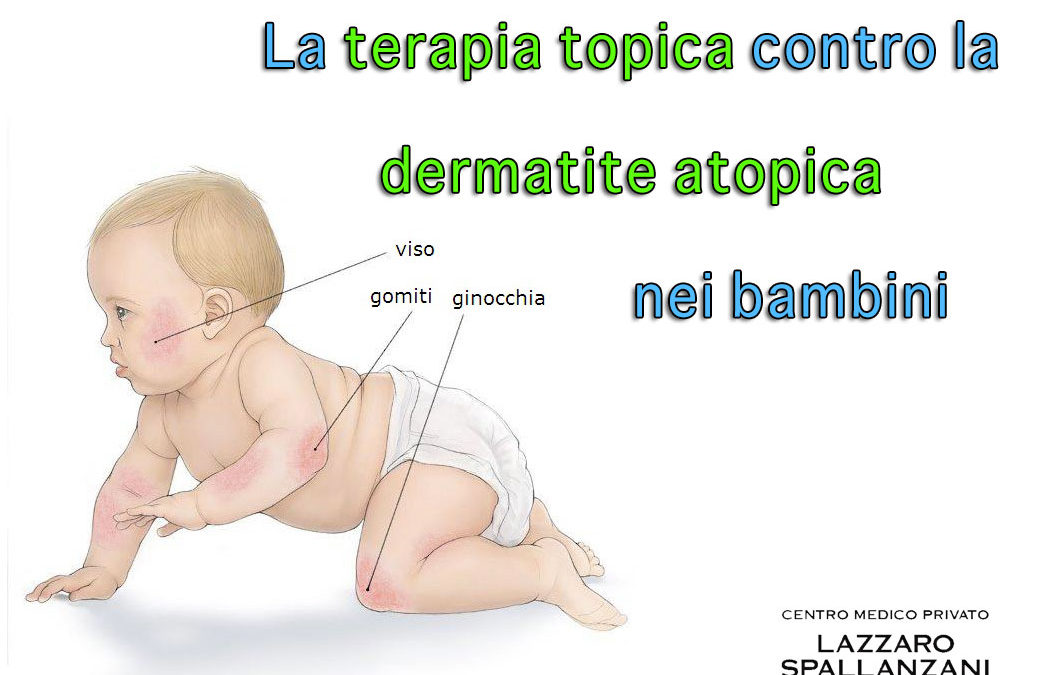 La terapia topica contro la dermatite atopica nei bambini