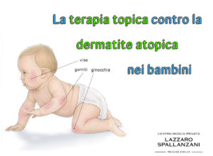 dermatite atopica
