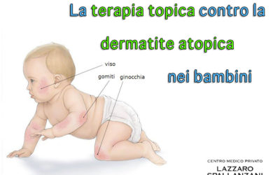 La terapia topica contro la dermatite atopica nei bambini