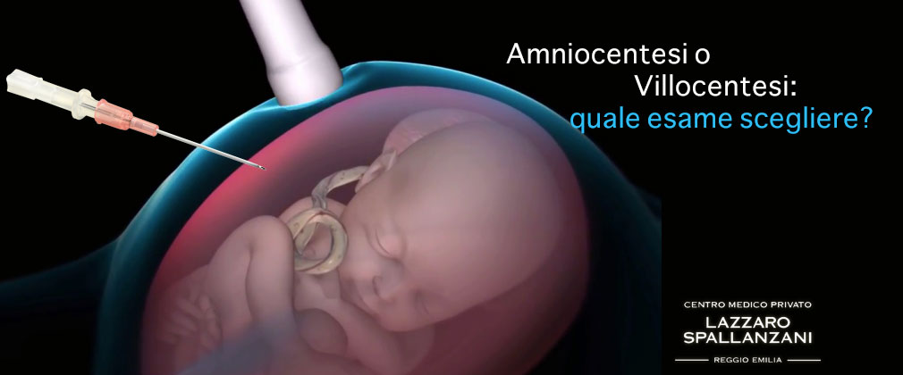 La difficile scelta tra Amniocentesi o Villocentesi