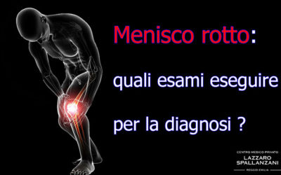 Menisco rotto: quali esami eseguire per la diagnosi?