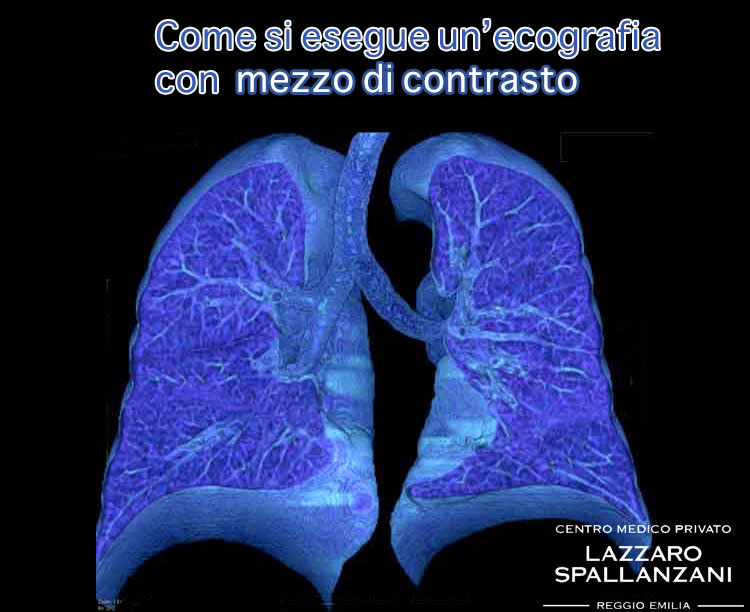 Come si esegue un’ecografia con mezzo di contrasto