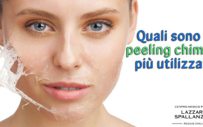 Quali sono i peeling chimici più utilizzati ?