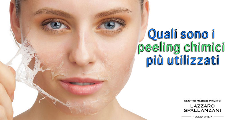 Quali sono i peeling chimici più utilizzati ?