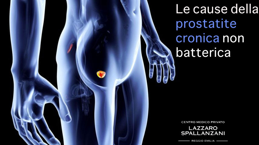 Le cause della prostatite cronica non batterica