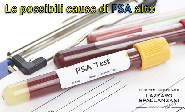 Le possibili cause di PSA alto