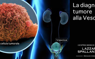 La diagnosi del tumore alla vescica