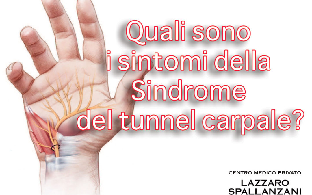 Alcuni sintomi della Sindrome del tunnel carpale