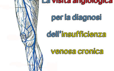 La visita angiologica per la diagnosi dell’insufficienza venosa cronica