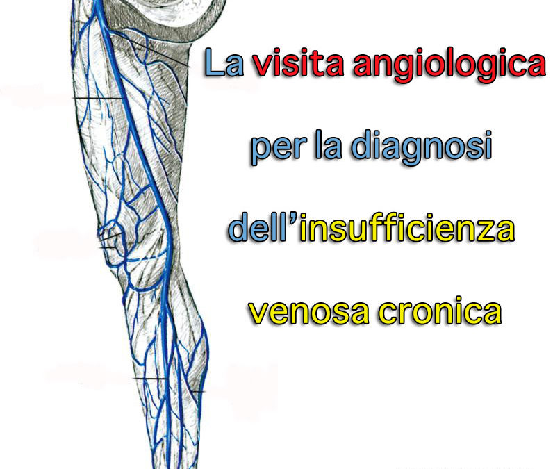 La visita angiologica per la diagnosi dell’insufficienza venosa cronica