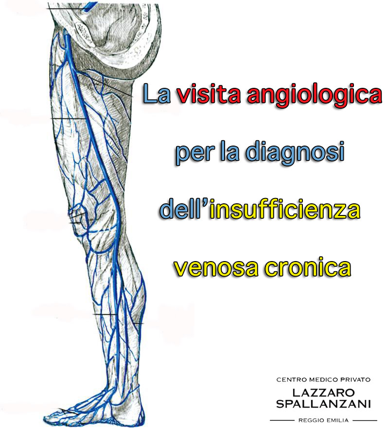 Visita Angiologica Come Si Puo Diagnosticare L Insufficienza Venosa Cronica