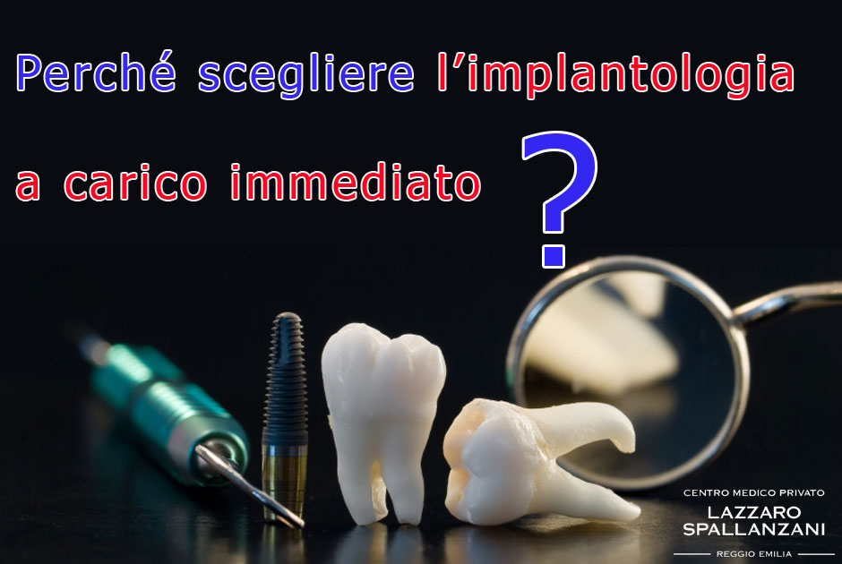 Perché scegliere l’implantologia a carico immediato?