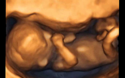 L’ecografia 3D in gravidanza