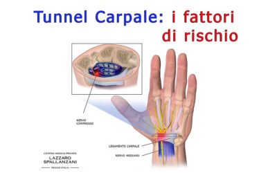 La sindrome del tunnel carpale e i fattori di rischio