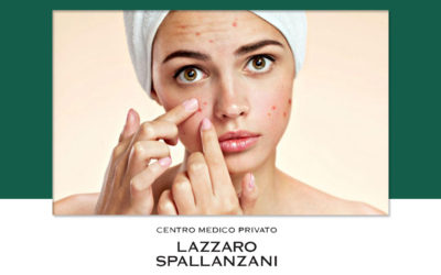 Alcune cause alla base dei problemi di acne