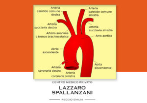 statine contro placca ateromasica