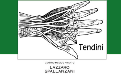 Come trattare i problemi legati alla tenosinovite