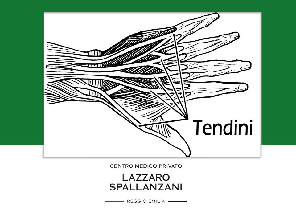 Come trattare i problemi legati alla tenosinovite