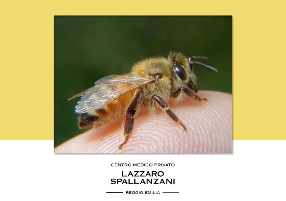Allergie agli imenotteri : come proteggersi dalle punture di insetti