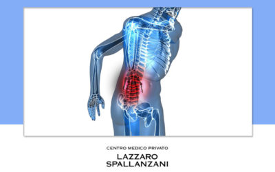 Quali sono i sintomi della sciatica?