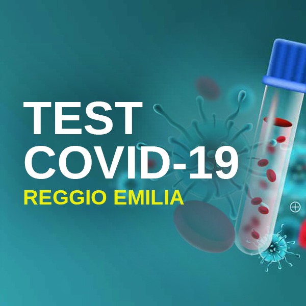 test covid 19 sierologico aziendale