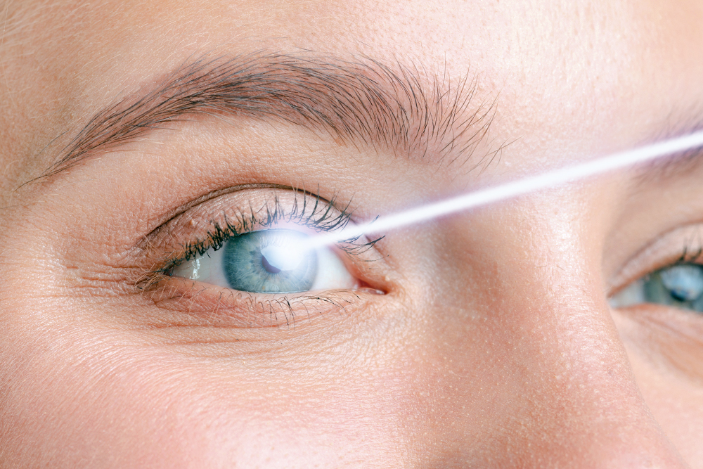 Intervento laser miopia femtolasik miopia
