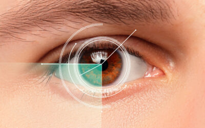10 motivi per cui considerare l’intervento laser eccimeri