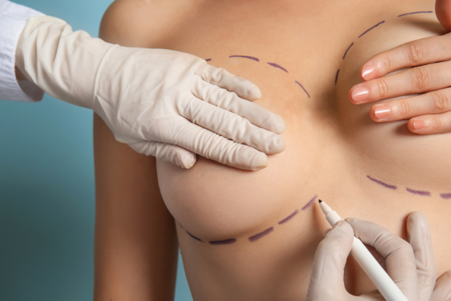 mastoplastica additiva intervento di chirurgia estetica